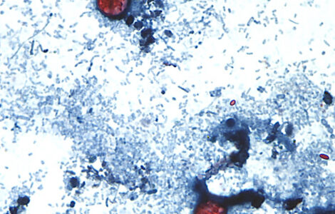 As cyclospora illnesses surge to a record, Michigan officials eye lettuce as a possible cause